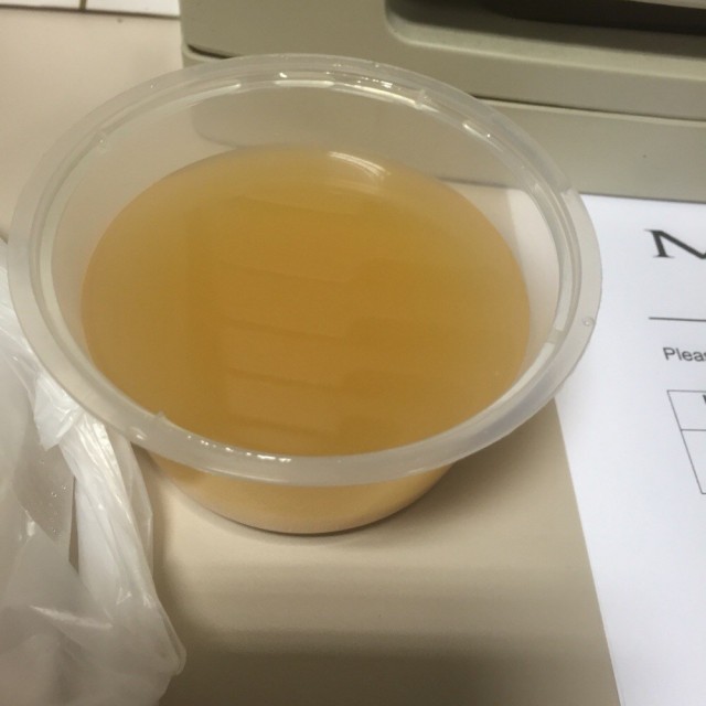 Miso Soup